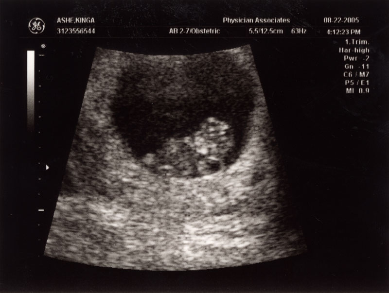 Ultrasound 1